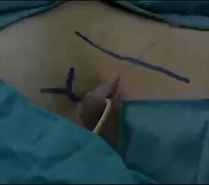 Doctor Constructs An Artificial Penis