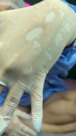 Medical Gloves