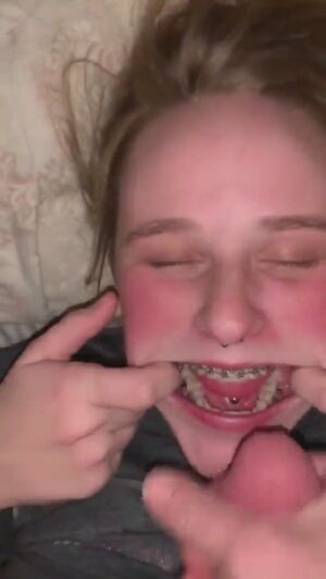 Braceface Amateur Braces Cum Cumshots