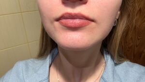 Lips & Tongues Amateur Blonde Braces