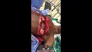Chest wound leaves man’s heart and lungs exposed