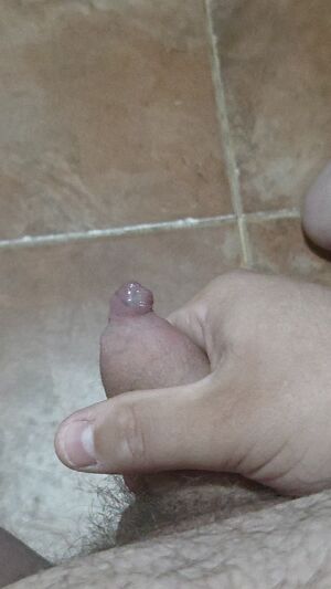 Tight Foreskin (Phimosis) Chubby Cum Cumshot