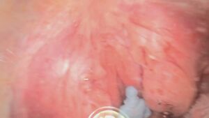 Uvulas Swallowing Throat Vore