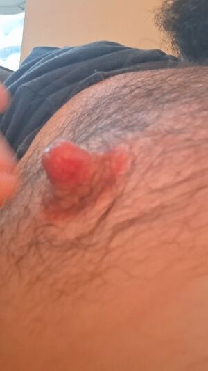 Gay Nipple Play Nipples