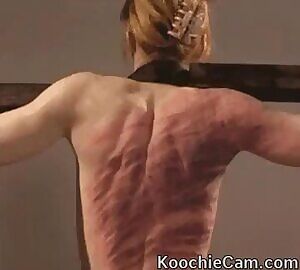 Incredibly bruised back