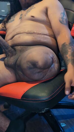 Tight Foreskin (Phimosis) Amateur Amputee Cock