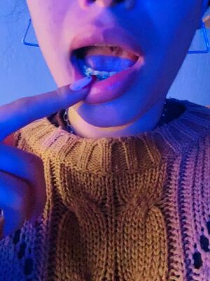 Drool/Spit Amateur Braces OnlyFans POV