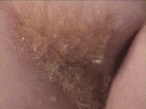 Firecrotch | True Gingers Hairy Pussy