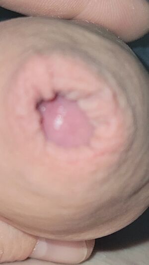 Foreskin Amateur Cock Foreplay Penis