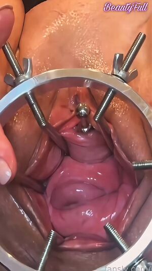 Stuffed Pussy Anal Speculum Extreme Gape