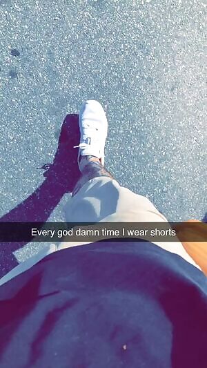 I wish I could wear shorts