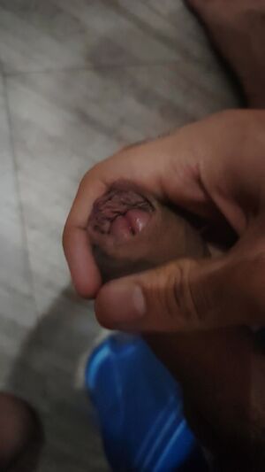 Tight Foreskin (Phimosis) Edging Male Masturbation