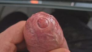 Tight Foreskin (Phimosis) Big Dick Bisexual