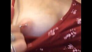 Now keep getting asked to see them with the metal in... I think you guys just wanted to see them again!! =P <3