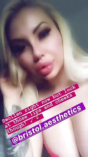 Nothing better than some freshly pumped lips